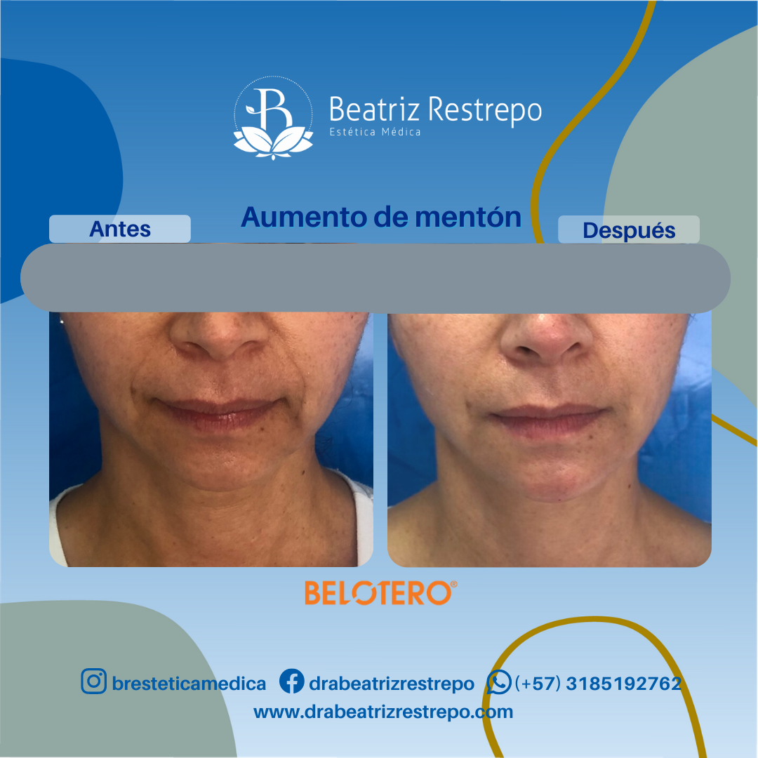 Beatriz Restrepo Estetica Médica photo 2
