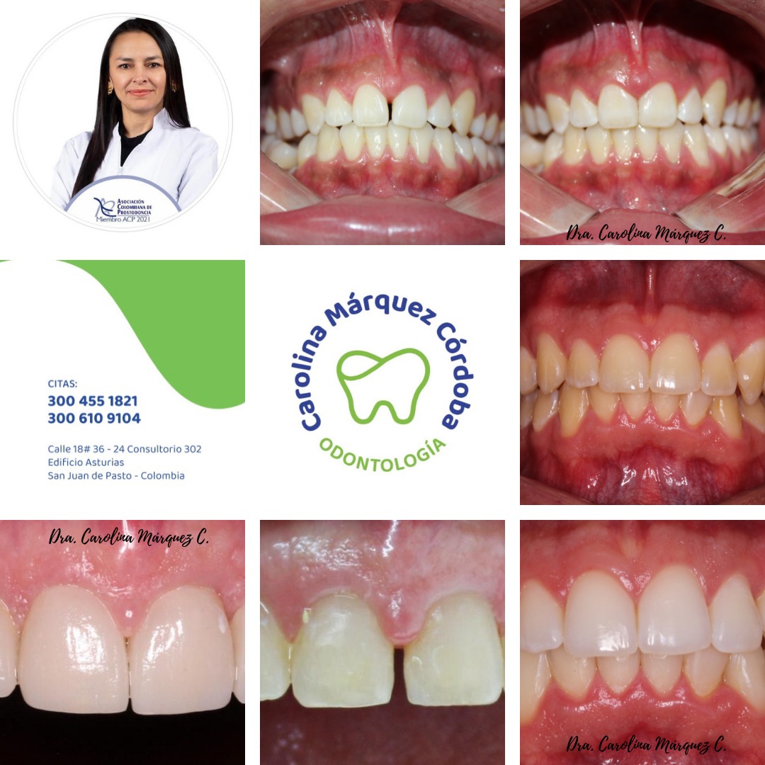 Carolina Márquez C - Odontología photo 2