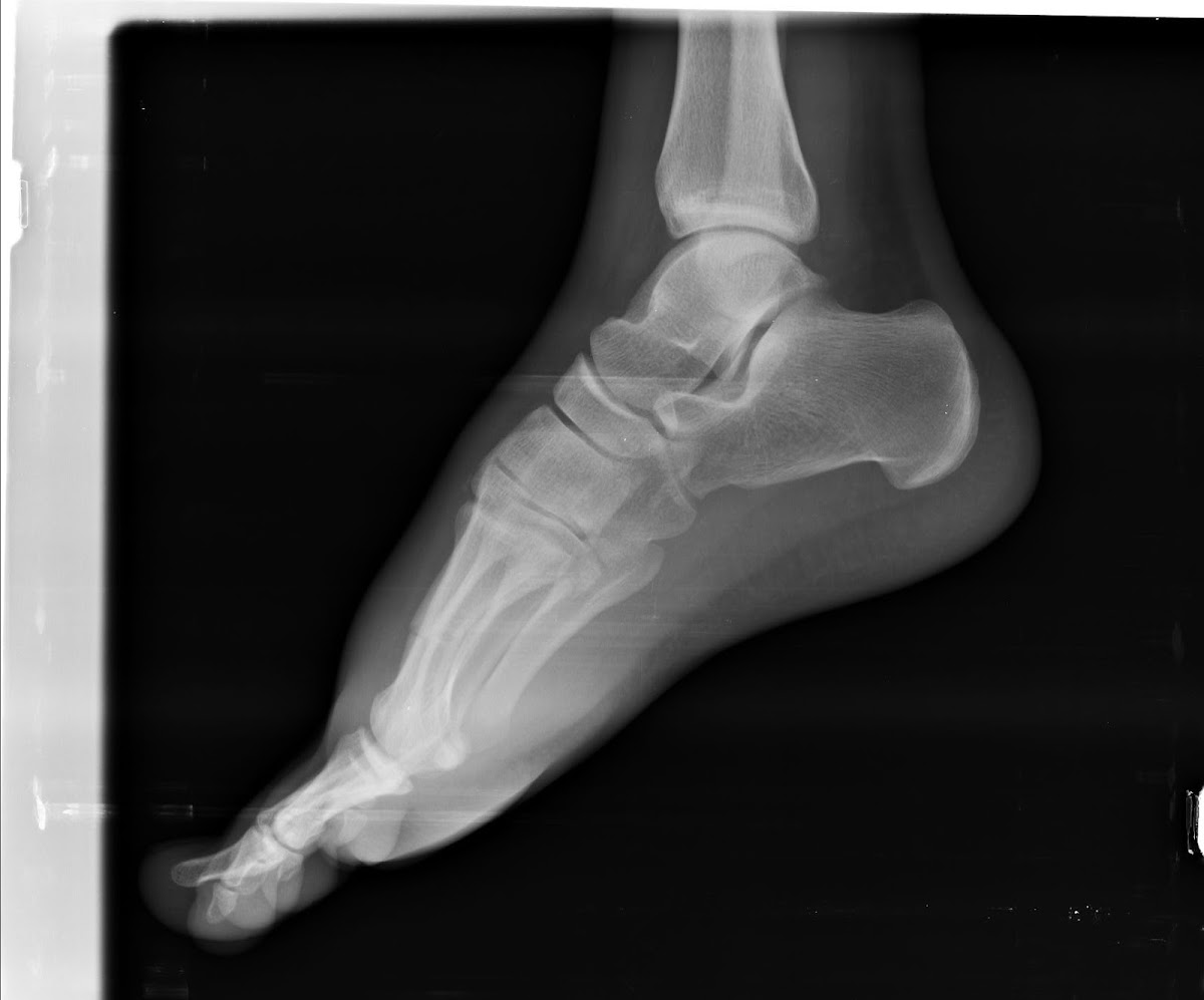 Centro Especializado en Fracturas y Lesiones Deportivas photo 3
