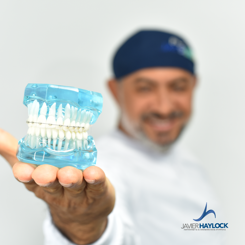 Doctor Javier Haylock Ortodoncia Sin Brackets