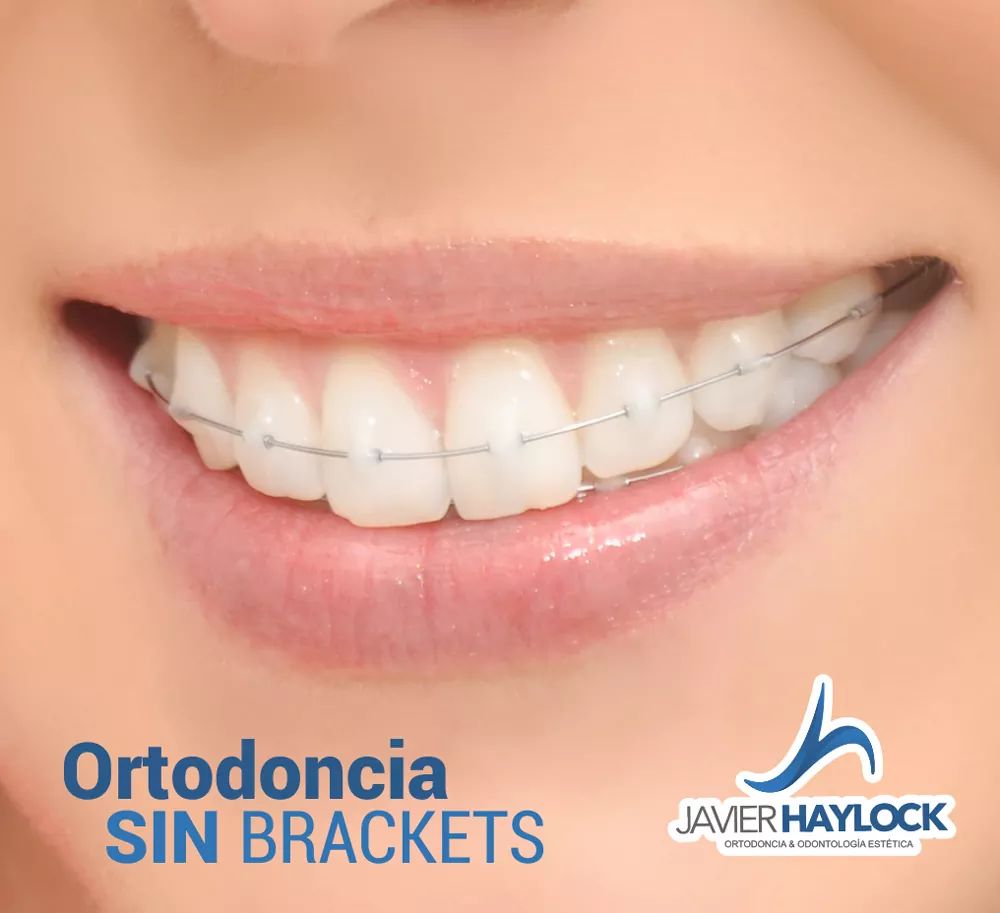 Doctor Javier Haylock Ortodoncia Sin Brackets photo 2