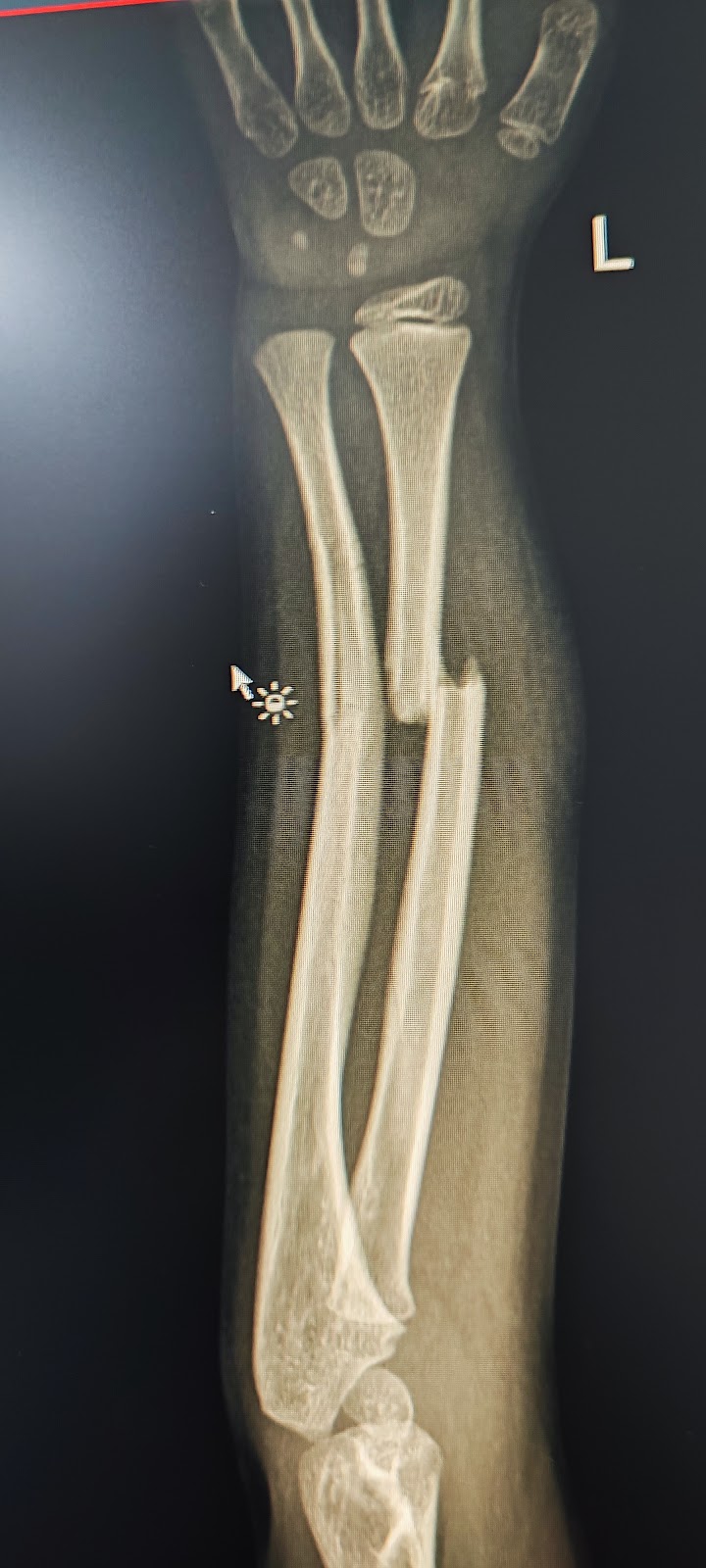 Dr. Carlos Andres Gordillo/ Ortopedista hombro y rodilla Cali photo 2
