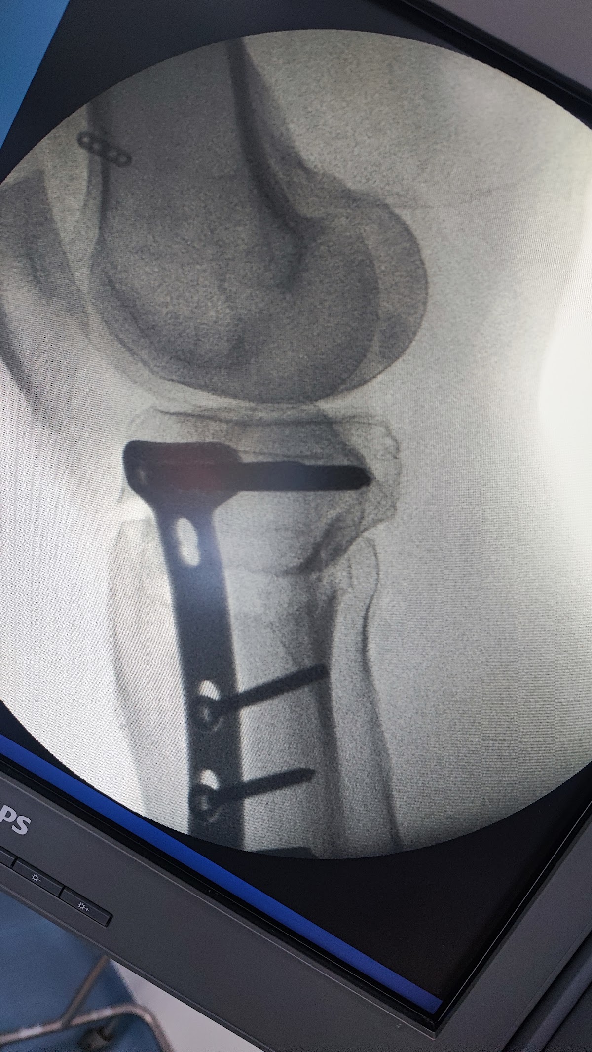 Dr. Carlos Andres Gordillo/ Ortopedista hombro y rodilla Cali photo 3