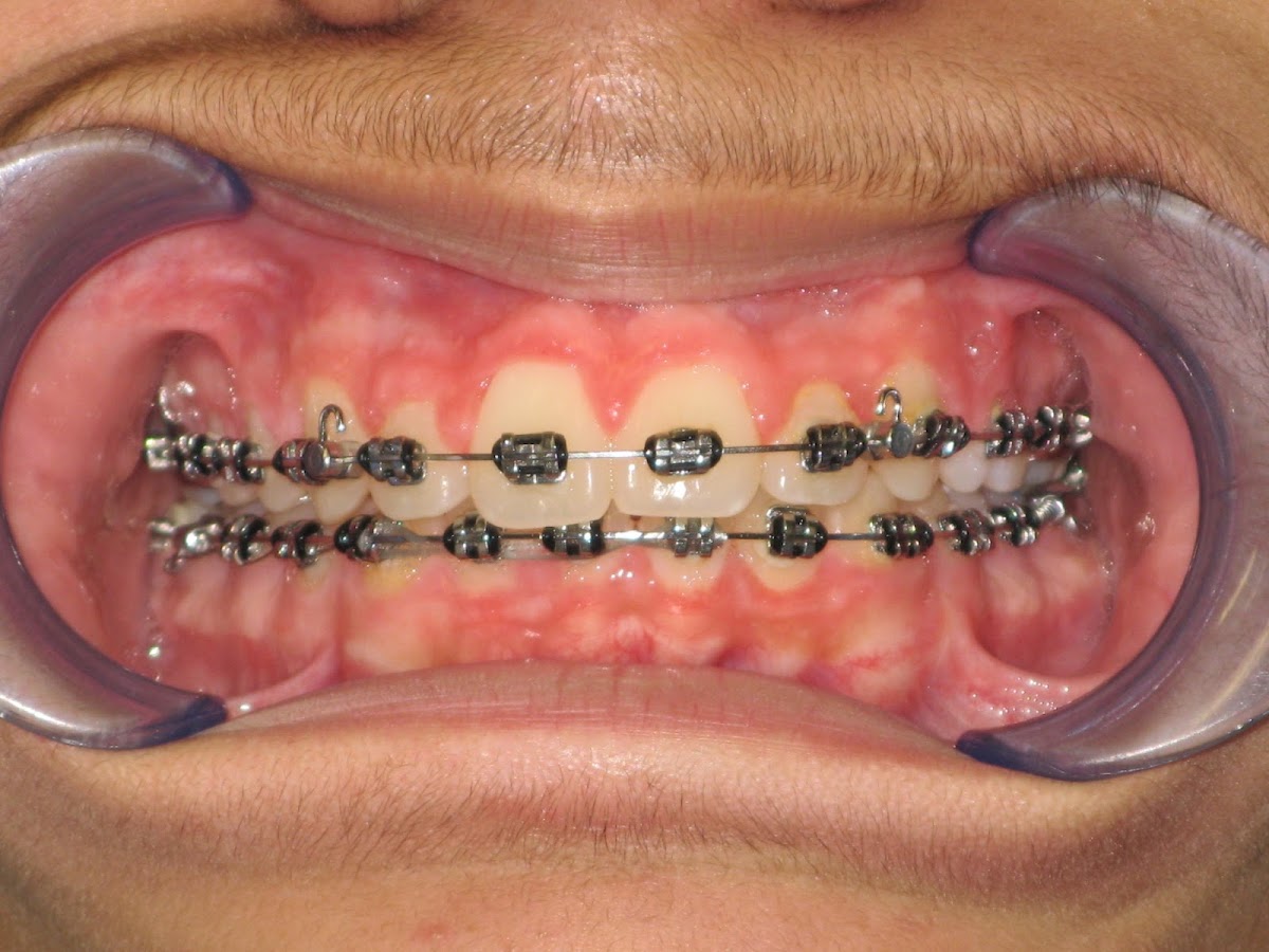Dr Carlos Lapeira Dental Studio photo 3