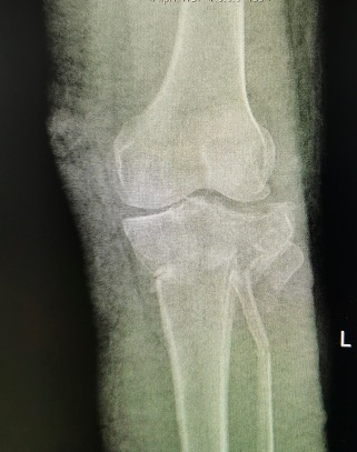 Dr. David Cabrera Ortiz, Ortopedista, Traumatólogo y Cirujano de mano photo 2