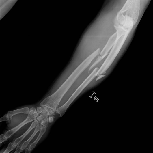 Dr. David Cabrera Ortiz, Ortopedista, Traumatólogo y Cirujano de mano photo 3