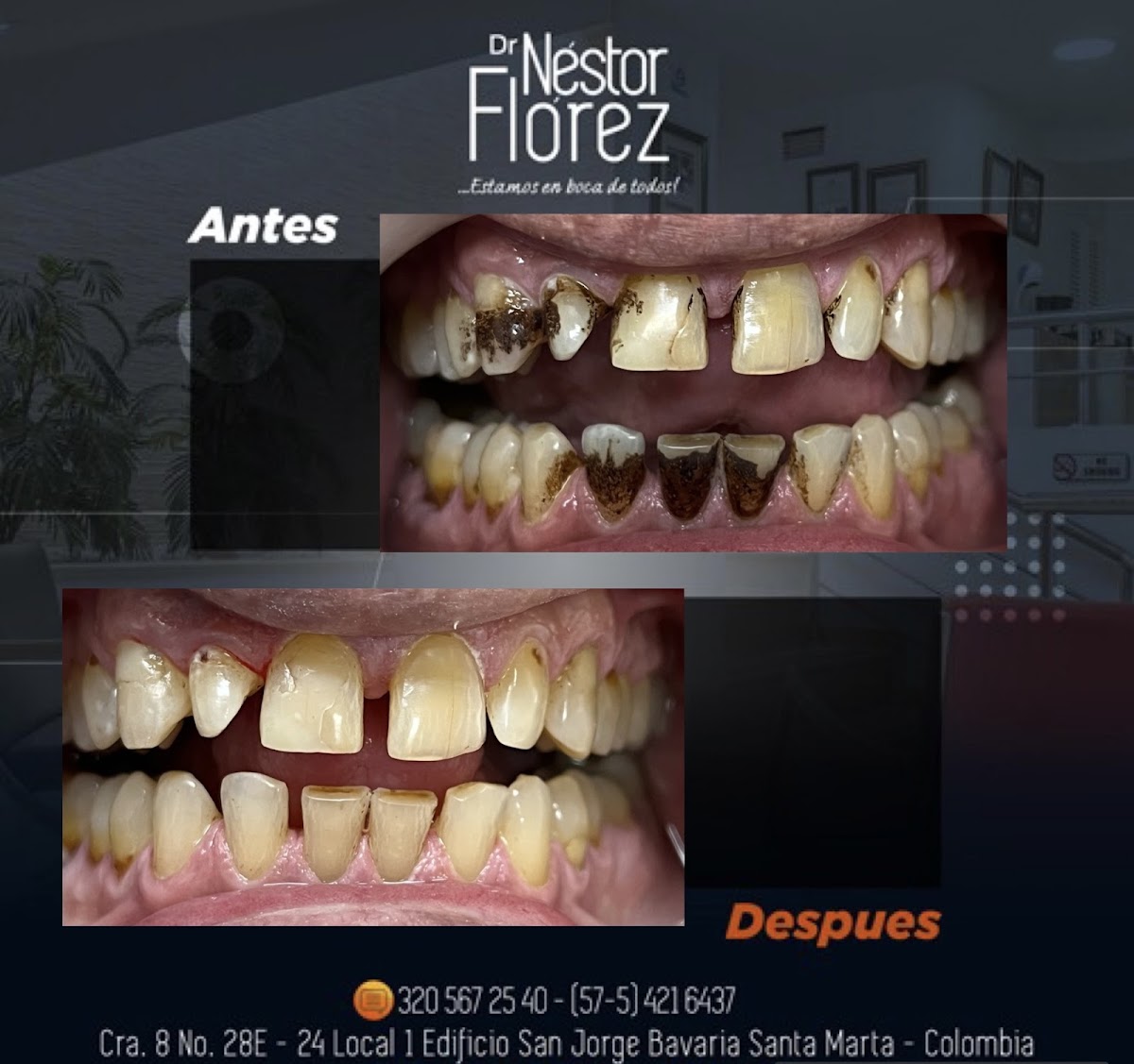 Dr Nestor E Florez .Odontologia Santa Marta photo 3