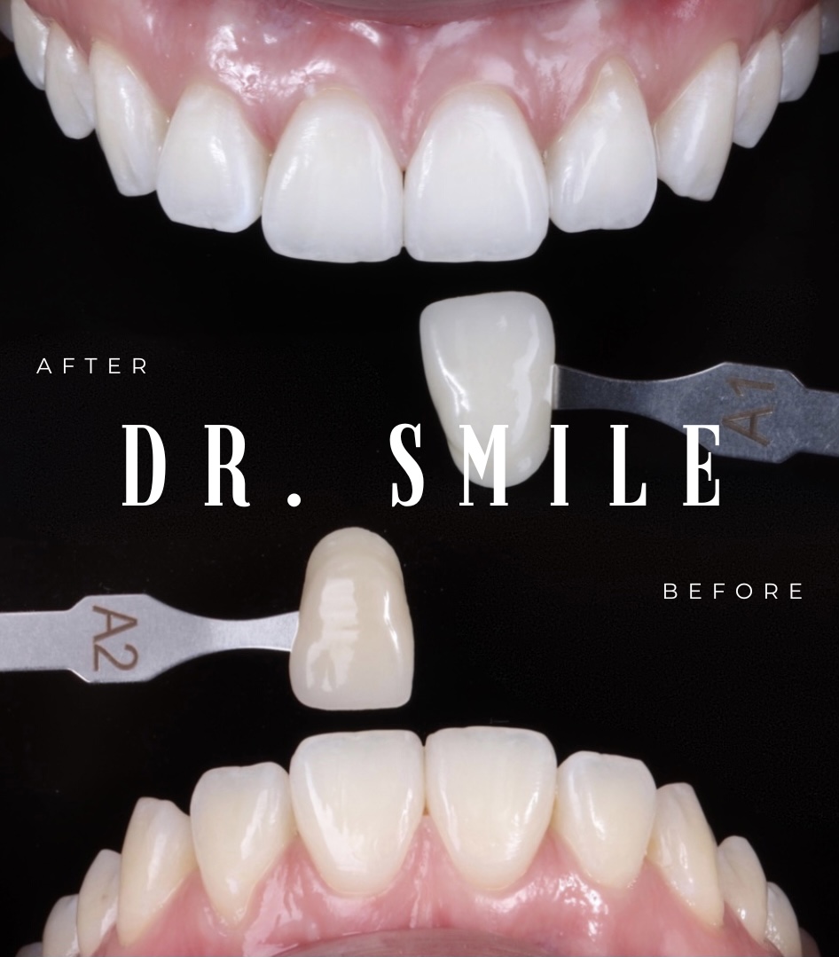 Dr smile - Estetica dental & ortodoncia en Pasto photo 2