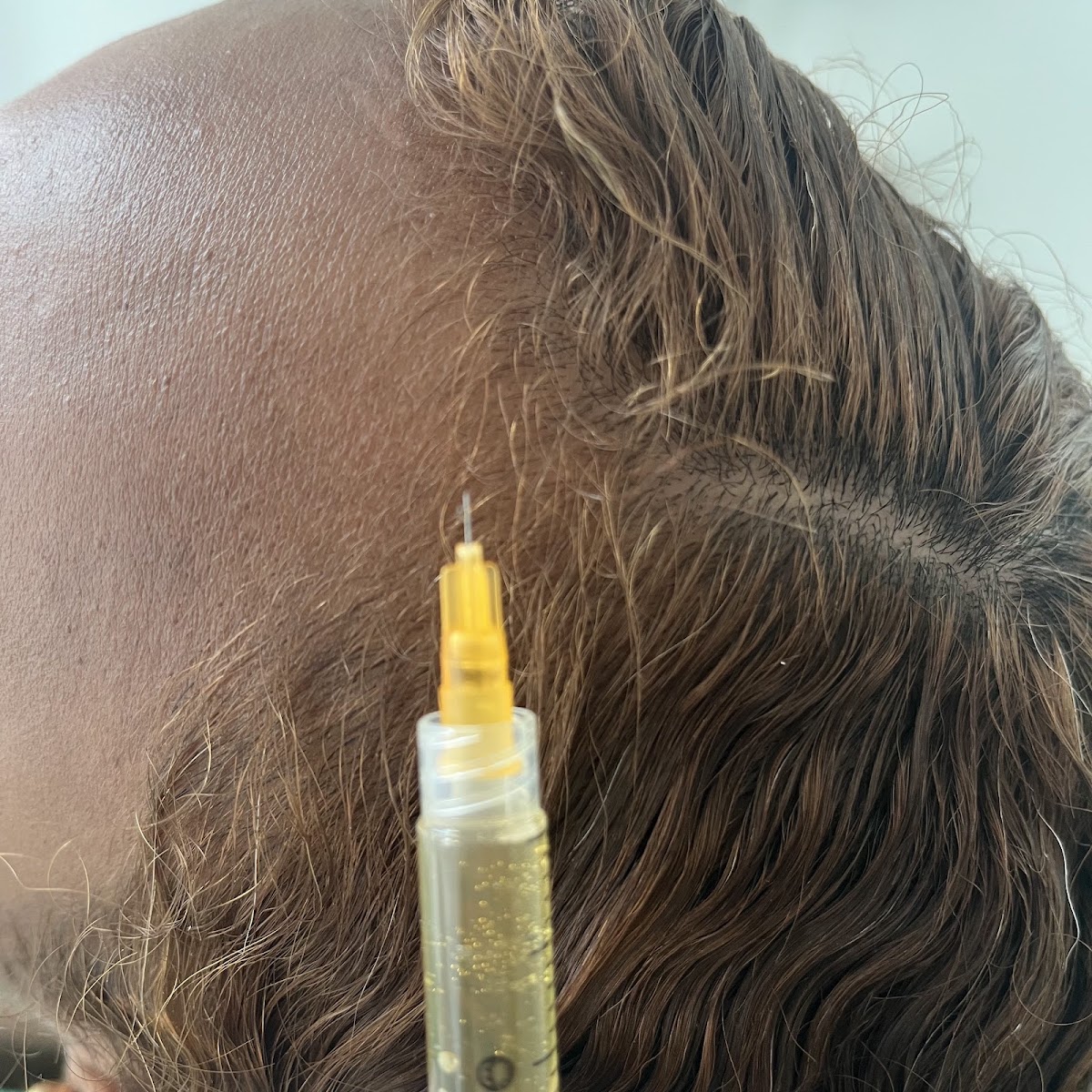Dra. Ana Martinez Ibarra, Dermatólogo photo 2