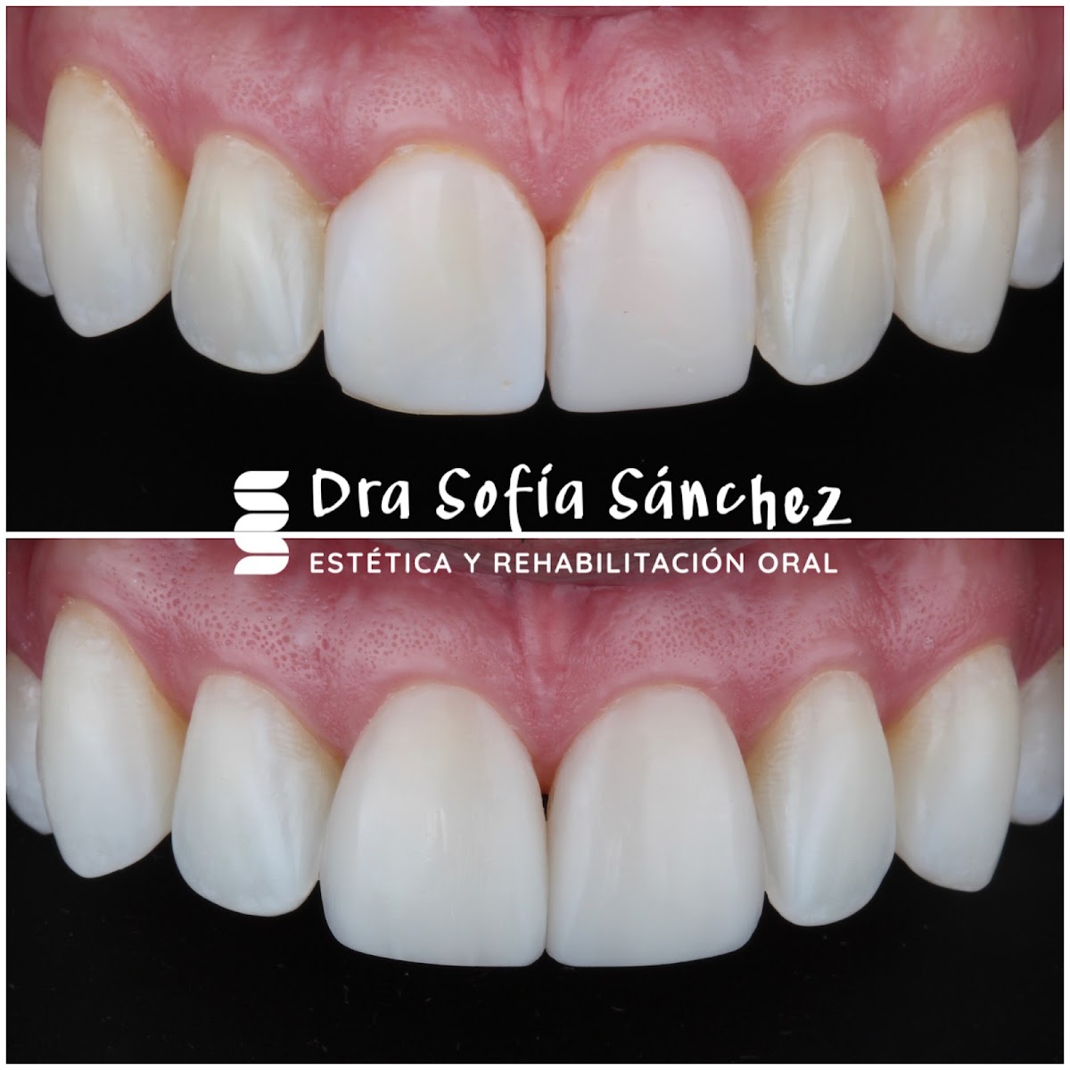 Dra. Sofía Sánchez - Estética y Rehabilitación Oral photo 3