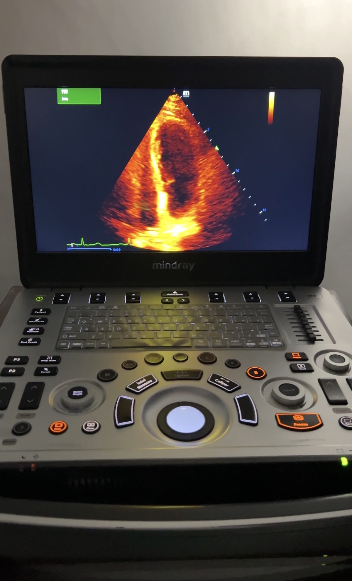 Ecocardioplus l Ecocardiograma en Medellín I Ecocardiograma particular