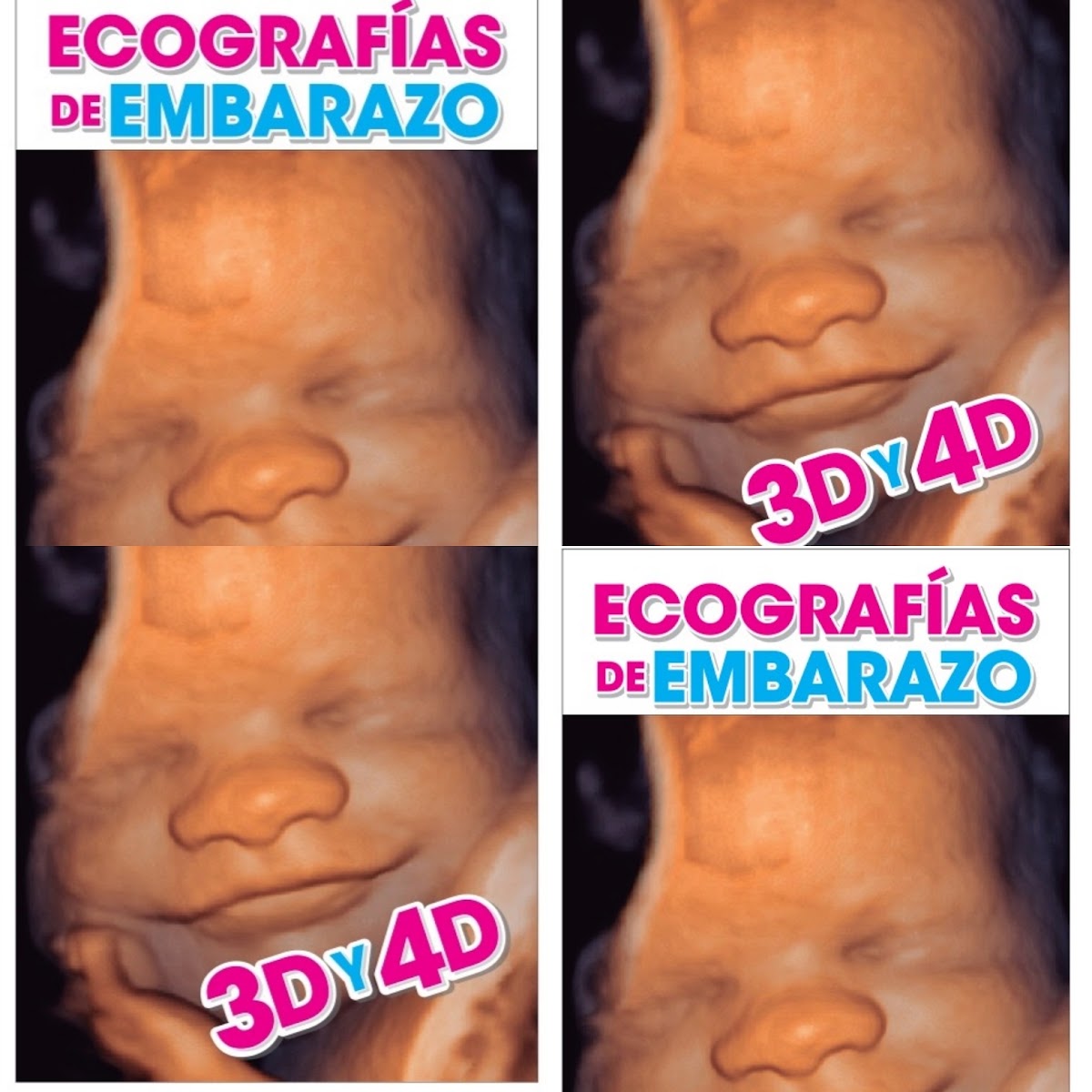 ecografias 3d y 4d en pereira photo 2