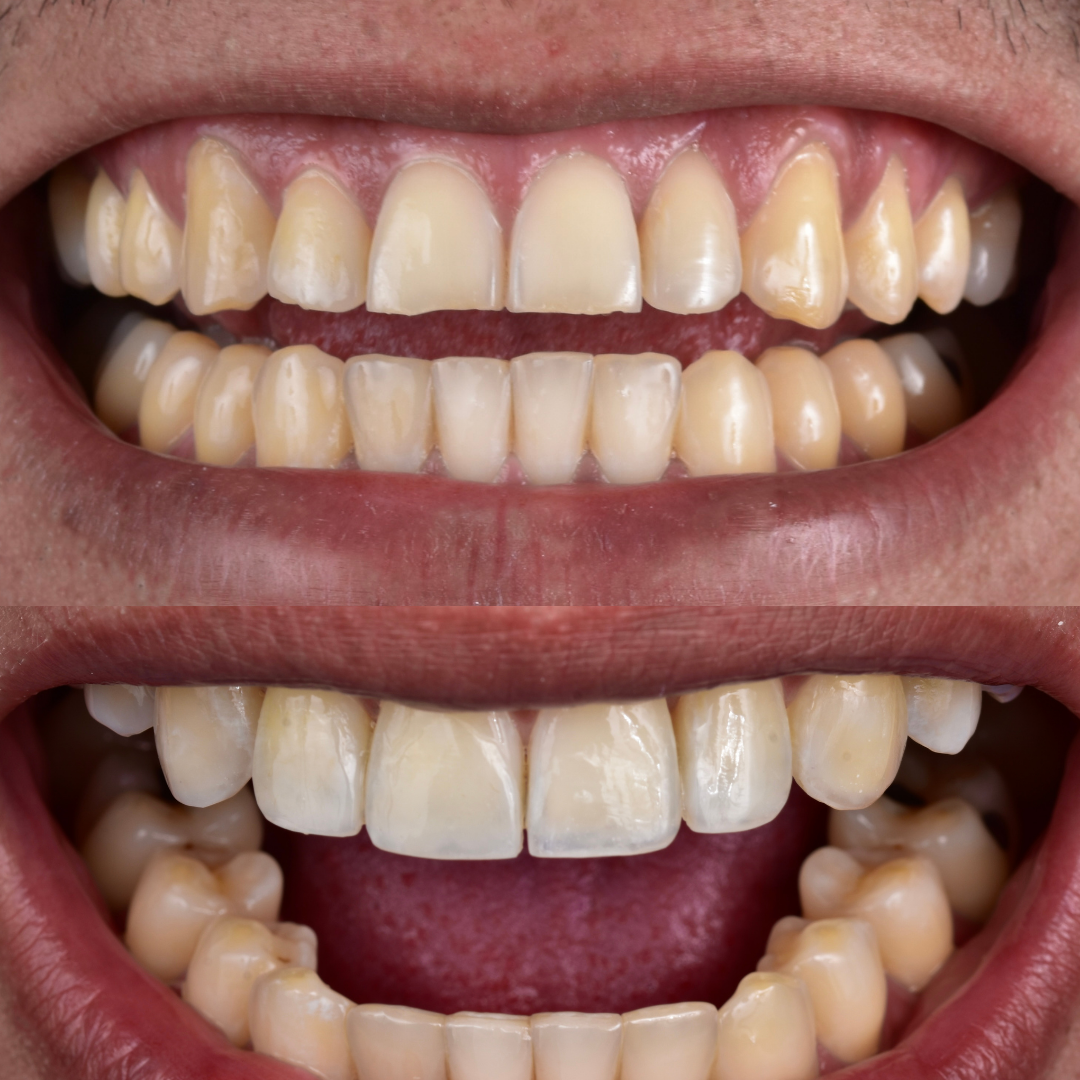 Felipe Clavijo Ortodoncia y Estética Dental