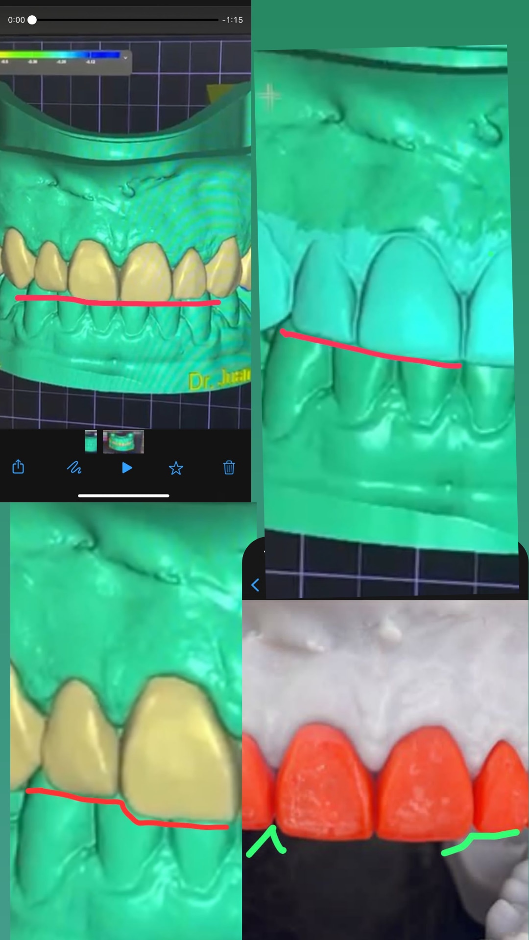 Marta Navarro LaserDentistry photo 2
