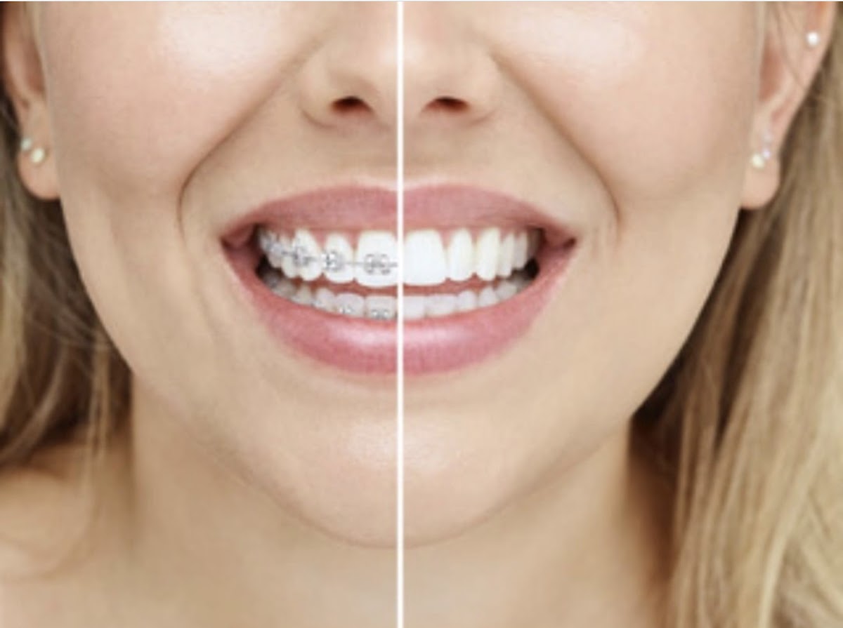 Marta Navarro LaserDentistry photo 3