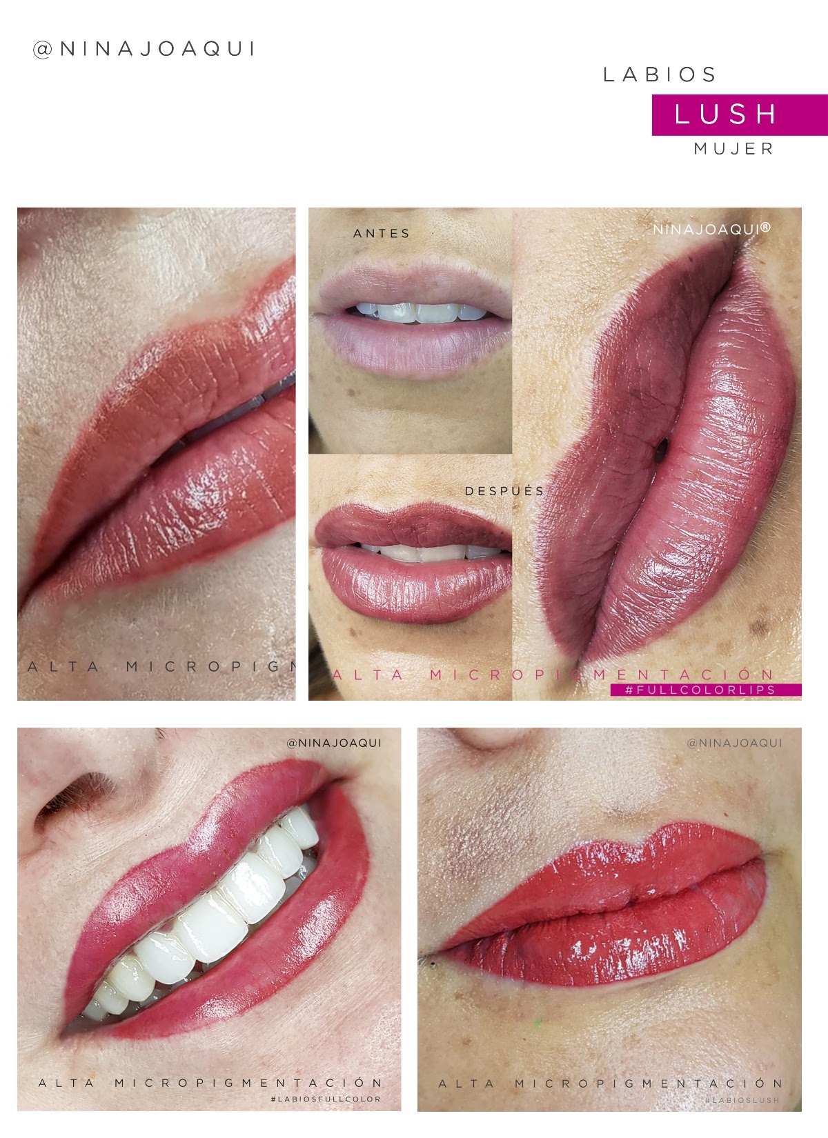 Nina Joaqui | Micropigmentacion | Estética Medica | Bótox | Bioestimuladores | Cursos de Micropigmentación y Estetica |
