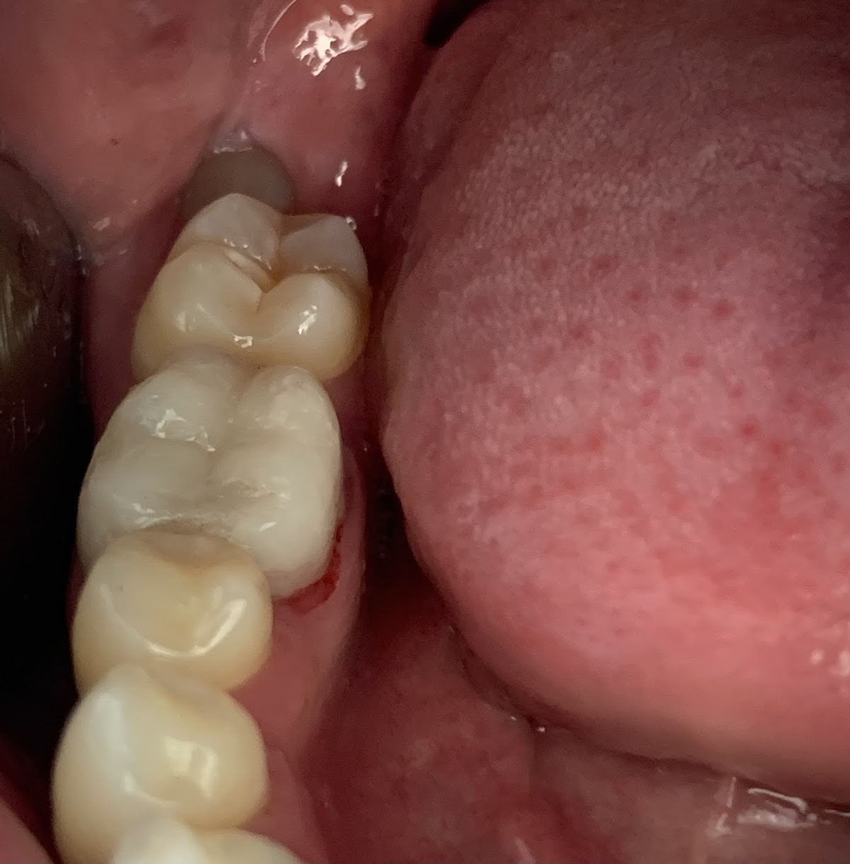 ORTHOSS, Dr José Adolfo Sanchez Molina photo 2