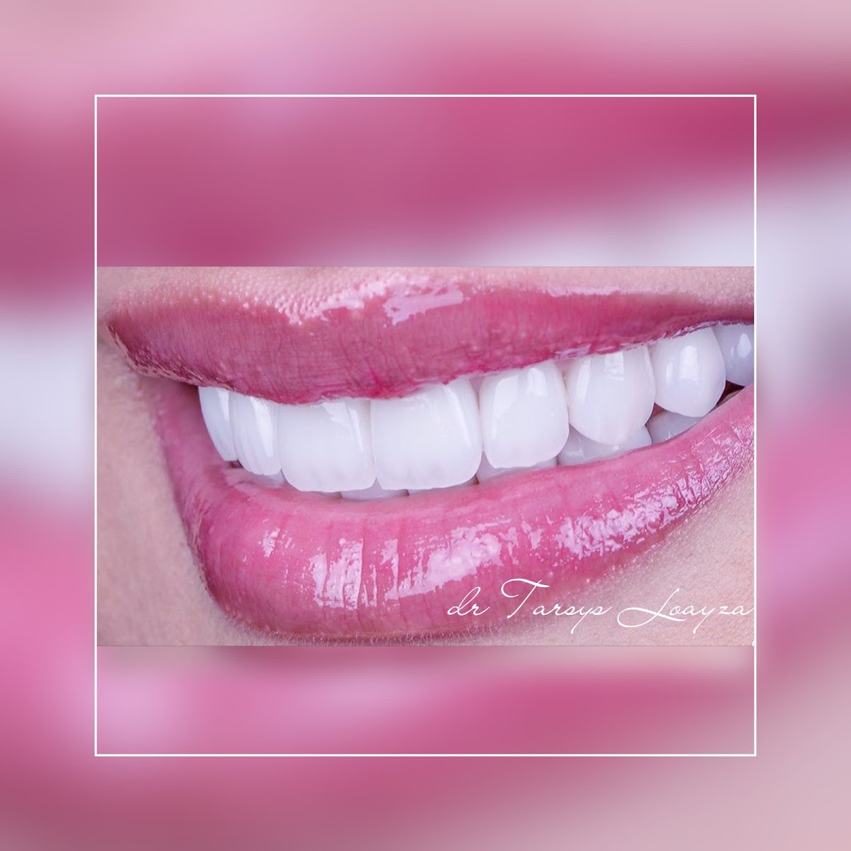Sonrisa Perfecta Dental - Tarsys Loayza Roys photo 3
