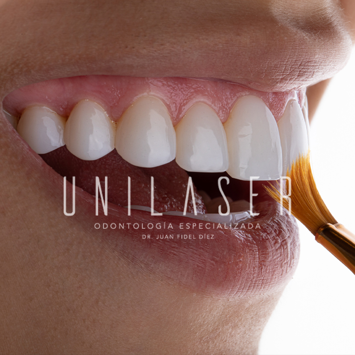 Unilaser Dental Clinic